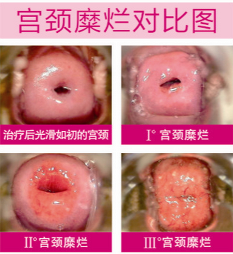 妇科检查的重要性与最新发展趋势